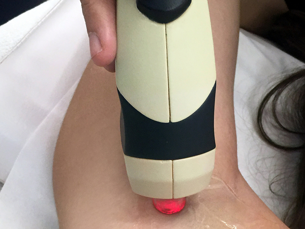 LASER-HAIR-REMOVER